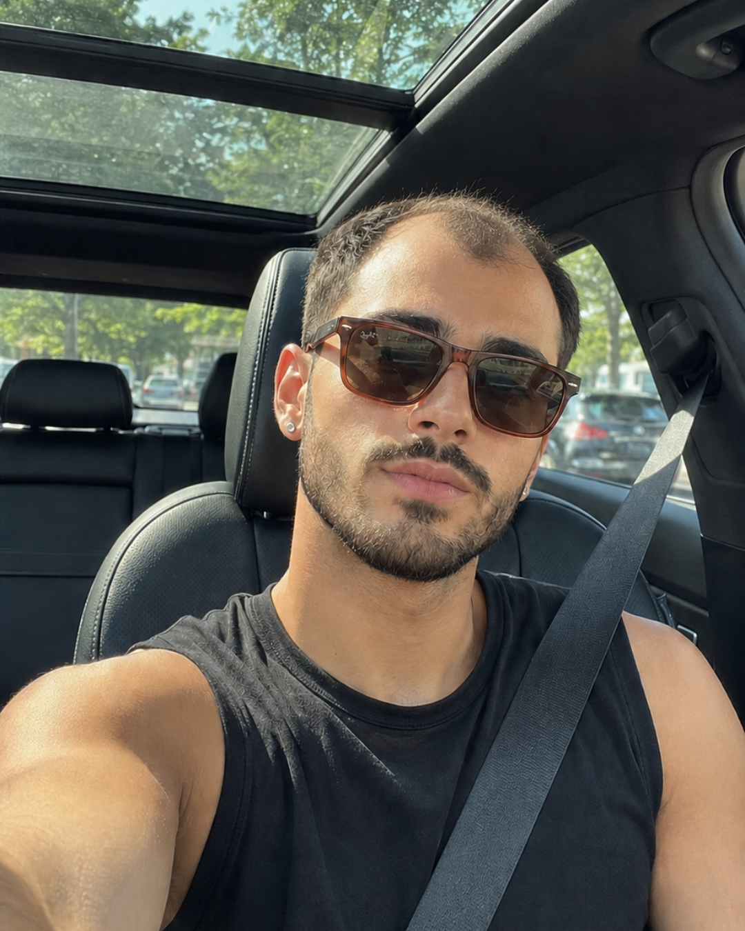 Before: original hairline